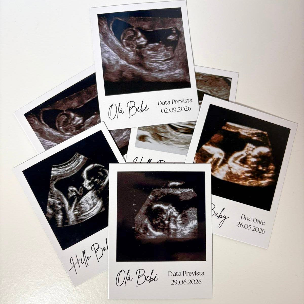 Ímanes de Ecografia Personalizados