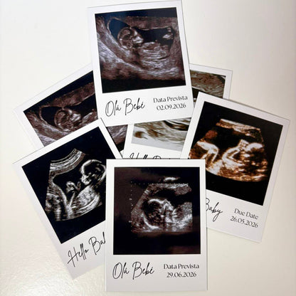 Ímanes de Ecografia Personalizados