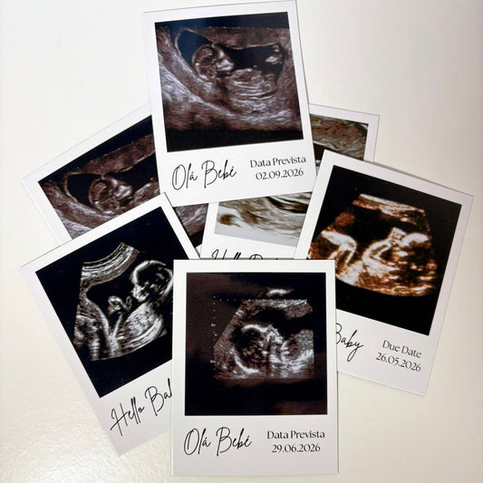 Ímanes de Ecografia Personalizados