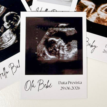 Ímanes de Ecografia Personalizados