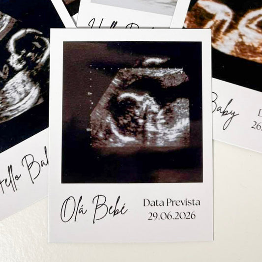 Ímanes de Ecografia Personalizados